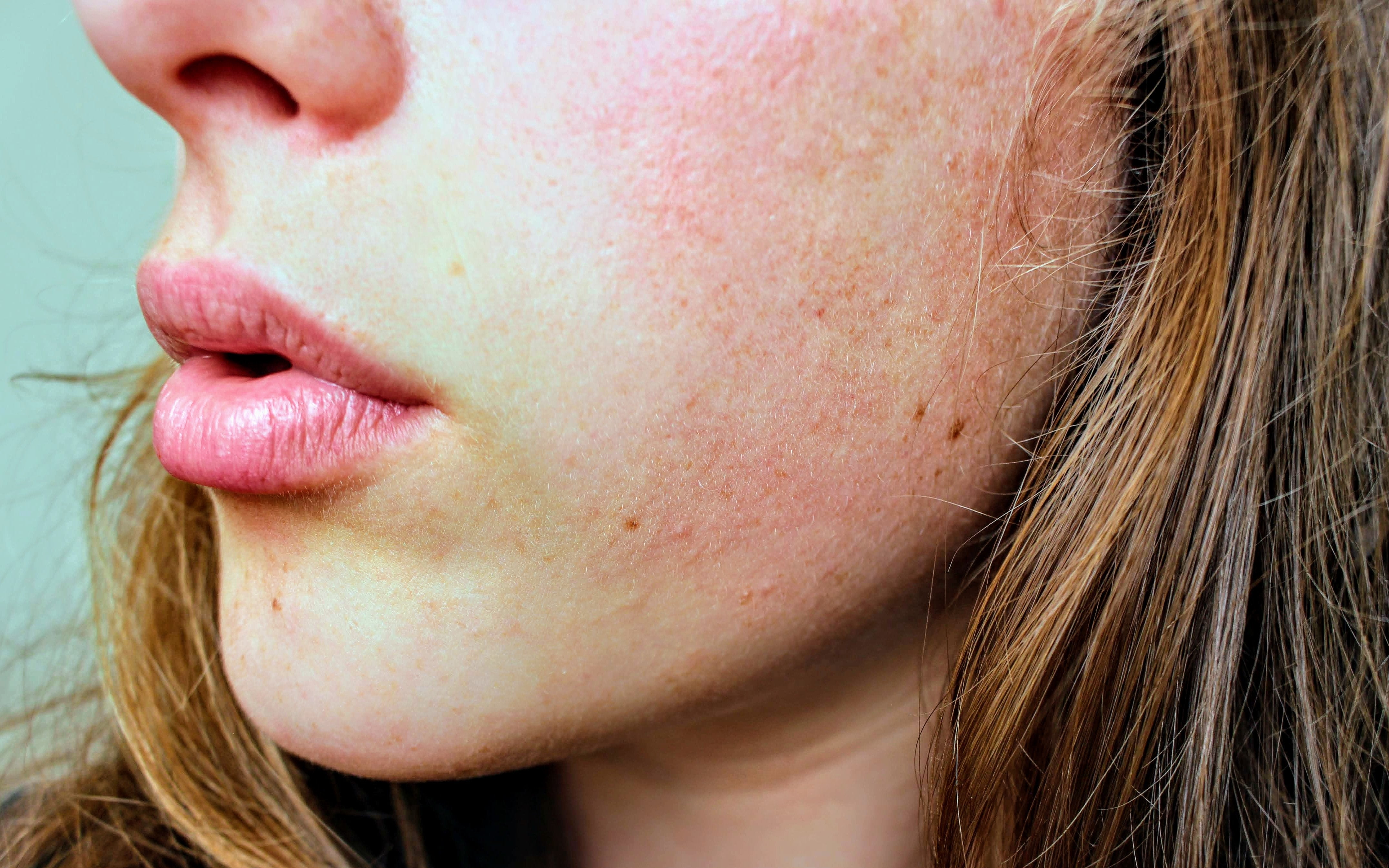 Protect your skin from irritants