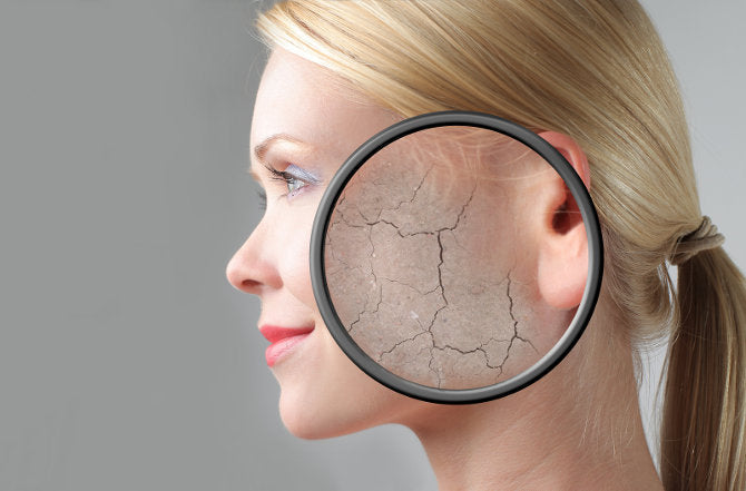 Woman in profile with a magnifier over her cheek showing dry, cracked skin — skin barrier explainer