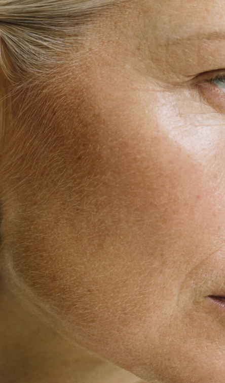 The 3 Biological Shifts in Skin Over 40